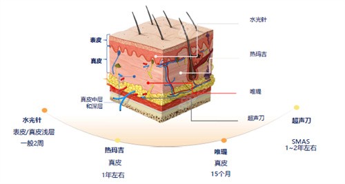 水光注射和其他项目的作用层次不同