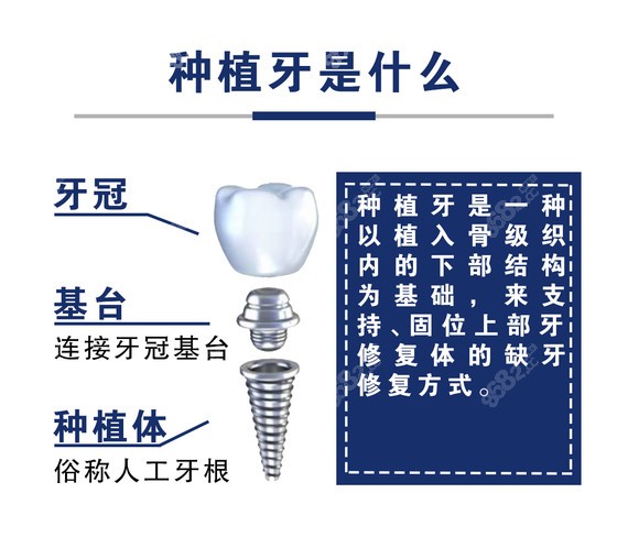 苏州镶牙哪家医院好还便宜www.8682.cc