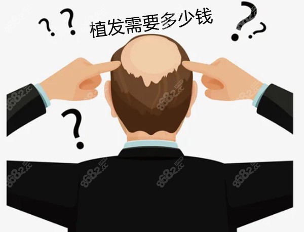 孝感植發(fā)費(fèi)用是多少