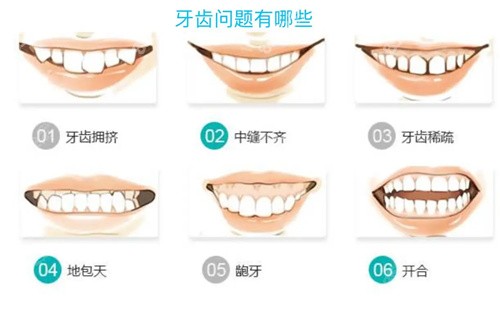 上海易美口腔的牙齿矫正诊疗技术高 上海易美口腔的牙齿矫正诊疗技术高