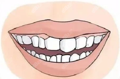 南阳植得口腔牙齿矫正价格7999元起 南阳植得口腔牙齿矫正价格7999元起