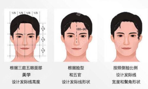 毳生植发美学设计植发方案