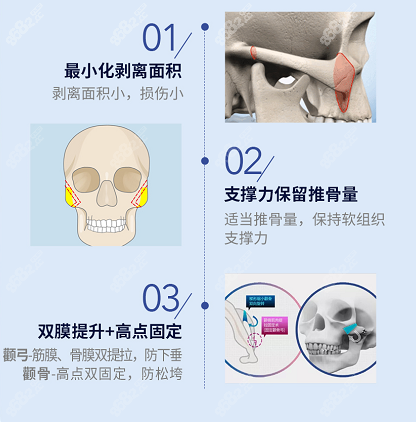 重庆星荣整形是重庆颧骨内推哪家医院好的首推医美