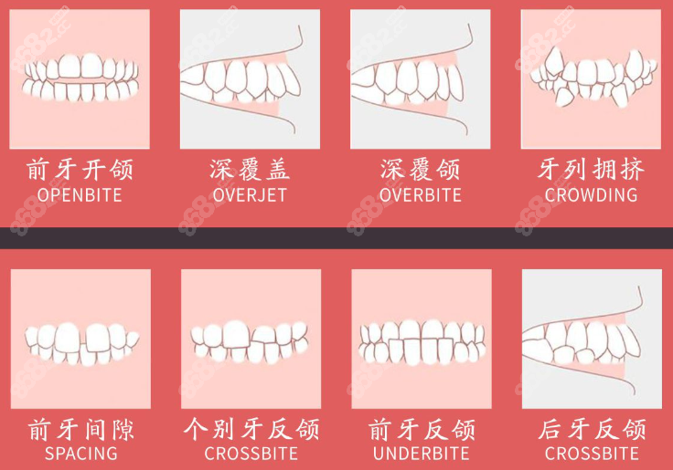 <!--<i data=20240705-sp></i>-->口腔牙齿正畸多少钱