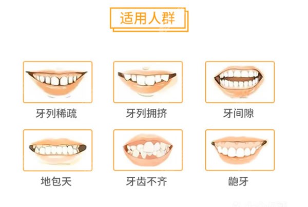 <!--<i data=20240705-sp></i>-->口腔牙齿矫正价格