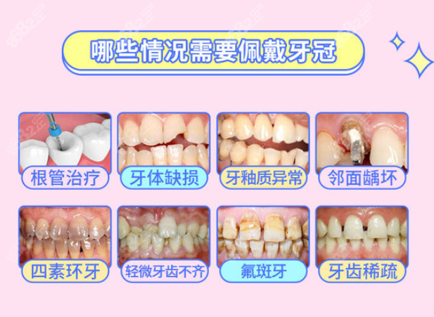 牙齿坏到牙神经不处理会怎么样www.8682.cc