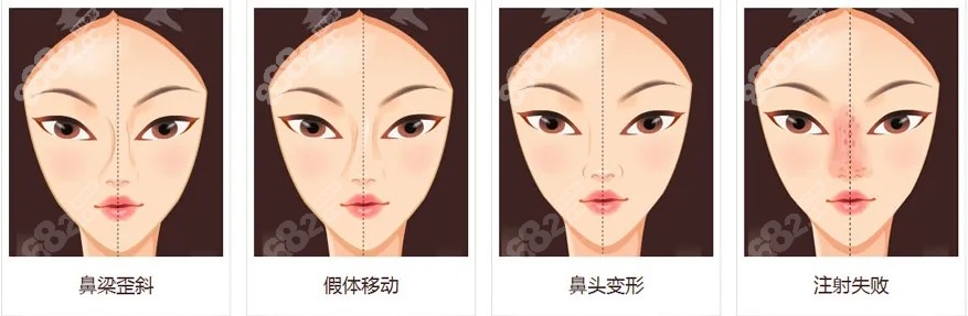 北京沃尔鼻修复经验多8682.cc
