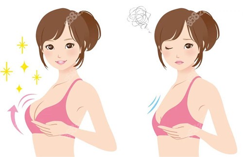 一万多的假体隆胸也是可以的