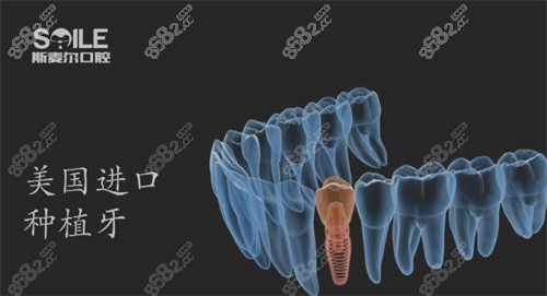 深圳斯麦尔口腔诊所种植牙