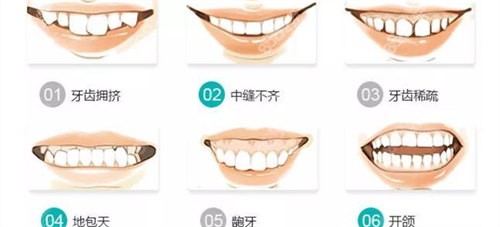 a3792ebab92ff8149a0b024045da9f91_f9929e28ea5d404ba4c402e7c3fe7398.jpg
