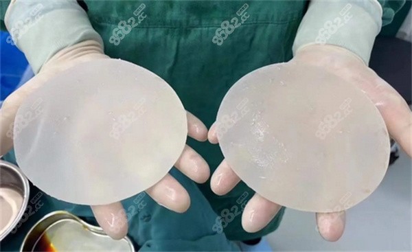 隆胸要做多大的假体合适？