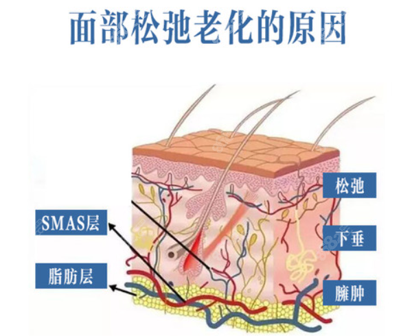 微拉美提升和超声炮区别大吗