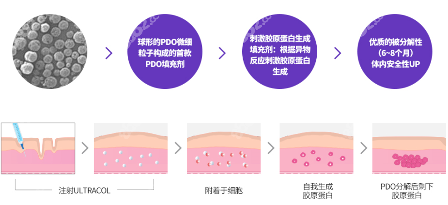 美尔韩推荐ULTRACOL胶原蛋白针注射过程