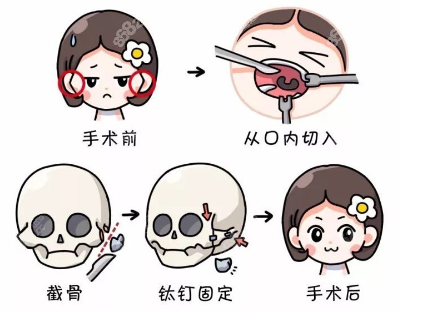 8682.cc介绍杜本军磨骨怎么样