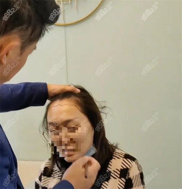 春草植發(fā)連鎖