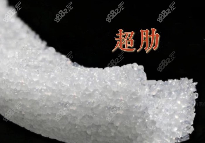 隆鼻假体超肋的特点www.8682.cc