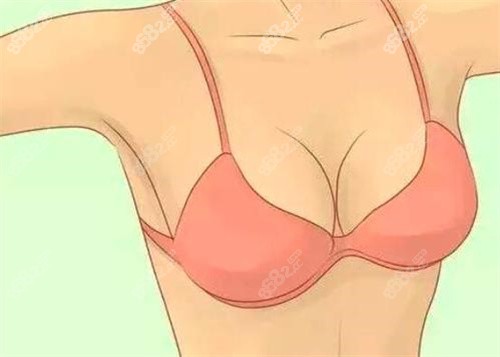 果冻隆胸可以一辈子吗？