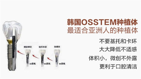 韩国奥齿泰种植牙特点及优势
