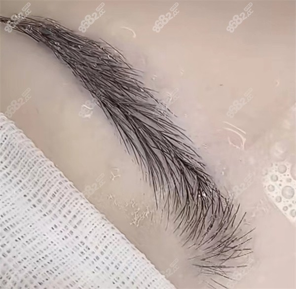 春草植發(fā)連鎖