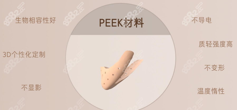 peek材料 3d打印填充高颅顶