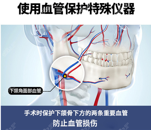 韩国TS整形磨骨仪器8682.cc