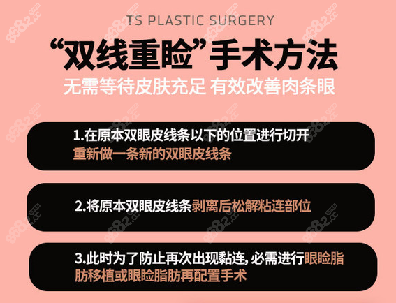 韩国TS整形医院眼修复优势