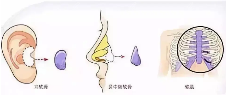 隆鼻收费标准m.8682.cc