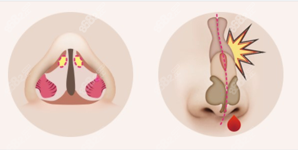 <!--<i data=20240705-sp></i>-->修复鼻子很厉害吗8682.cc