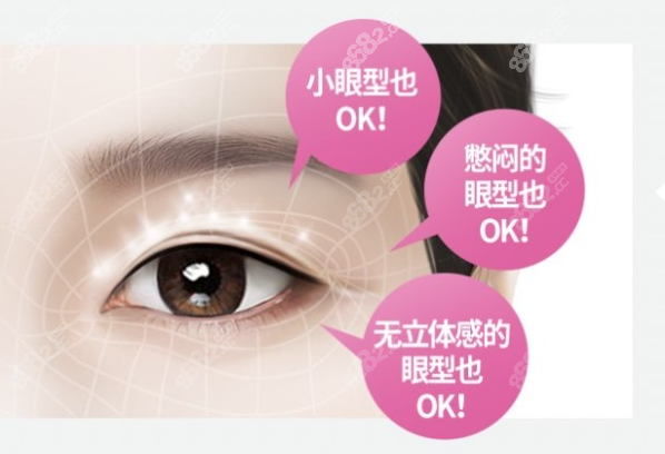 北京张海明做的双眼皮怎么样