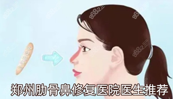 郑州肋骨鼻修复医院医生推荐