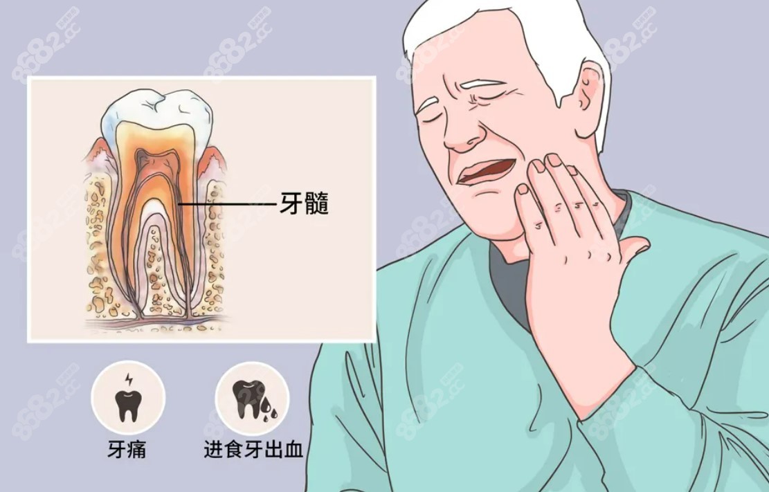牙髓炎不疼了还需要治疗吗