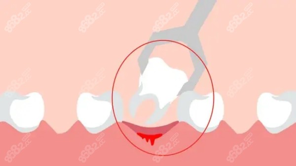 杭州萧山区牙科拔牙怎么样