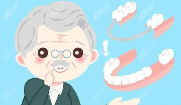 德州全口价格大概需要多少费用？