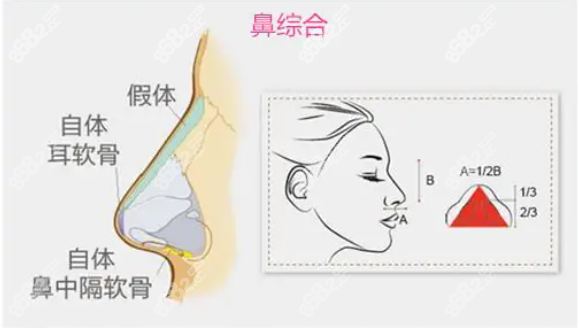 东莞华美詹慧鼻修复手术8682.cc