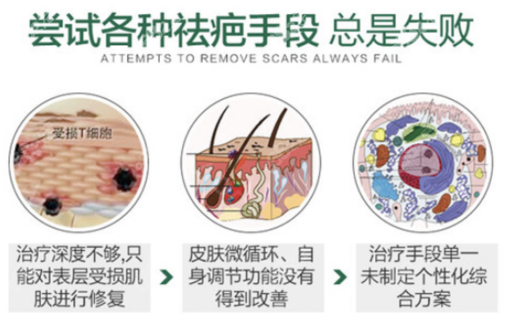 成都军建医院治疗疤痕好不好www.8682.cc