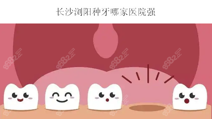 长沙浏阳种牙哪家医院强