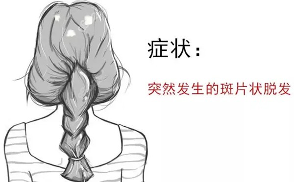 桂林贞韩斑秃植发要多少钱