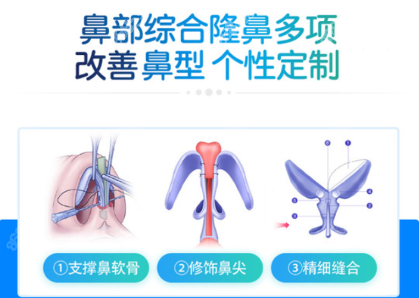 温科磊医生做鼻子技术好吗