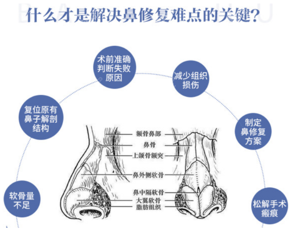 假体鼻子疤痕挛缩凹陷怎么办