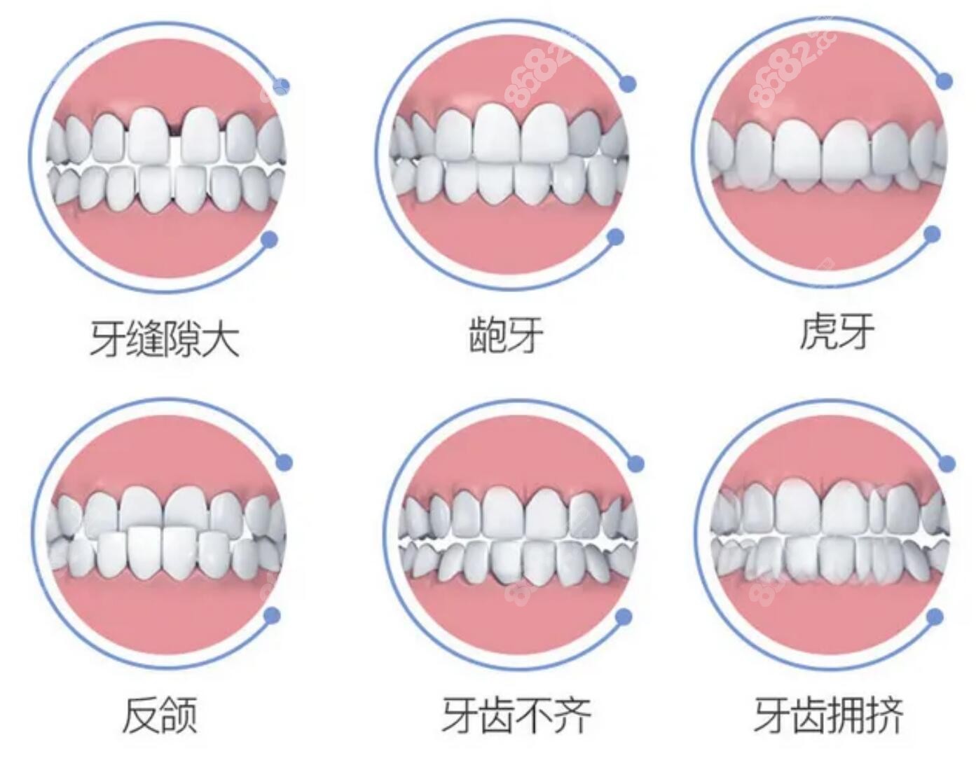 深圳平湖禾花地铁口牙科哪家好