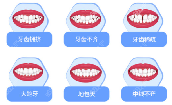 杭州下沙牙齿正畸医院排名