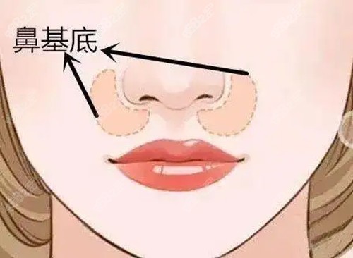 杨文忠隆鼻技术优势
