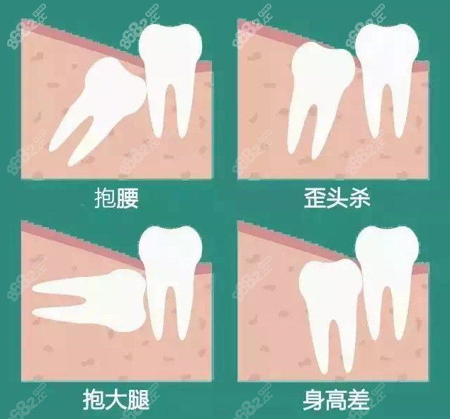 富阳区拔牙好的口腔医院排名推荐