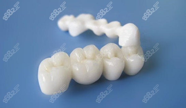 纯钛聚合瓷牙是什么8682.cc
