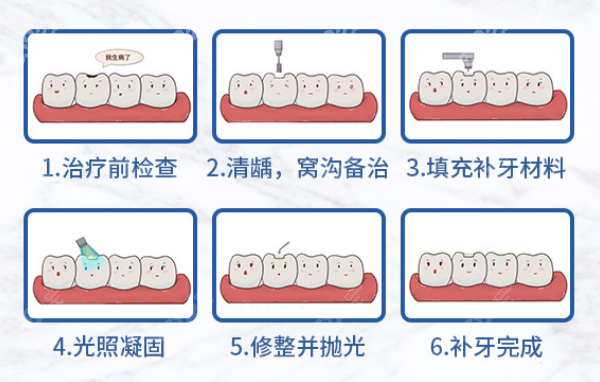 补牙过程图解