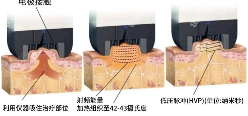 www.8682.cc钻石超塑溶脂原理图