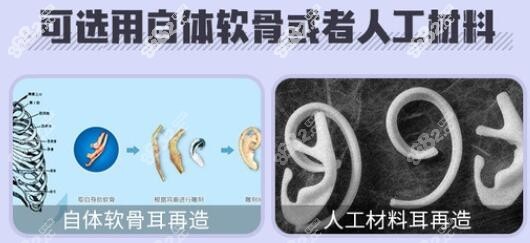 广州高尚的余文林医生耳再造材料8682.cc
