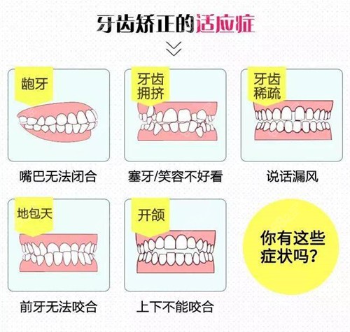 牙齿矫正