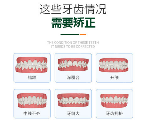 兰州做牙齿矫正好的医院名单