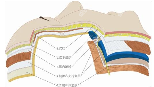 PSV面部提升术是什么（m.8682.cc）